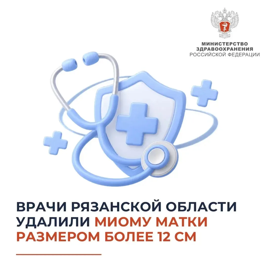 🏥 Врачи Рязанской области удалили миому матки размером более 12 см