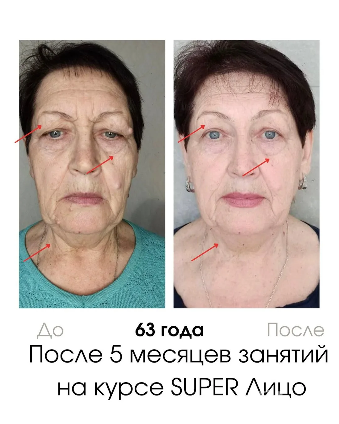 Изображение 2 к публикации «Гимнастика для лица»