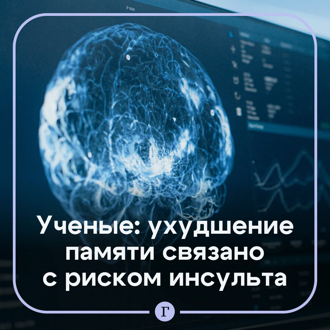 🤔 Ухудшение памяти после 60 лет связано с риском инсульта, выяснили ученые.