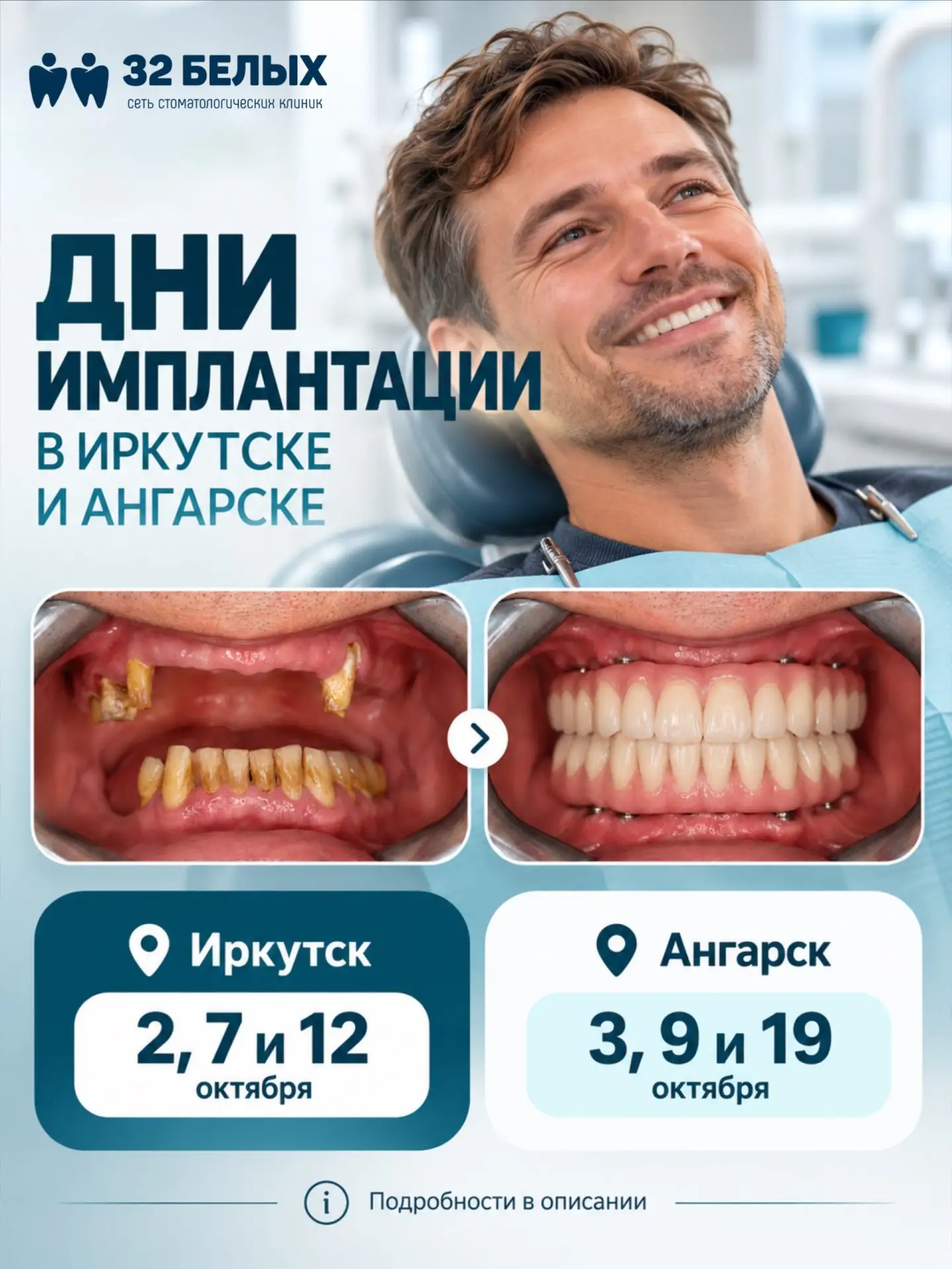 Думаете об имплантации, но не знаете, с чего начать?