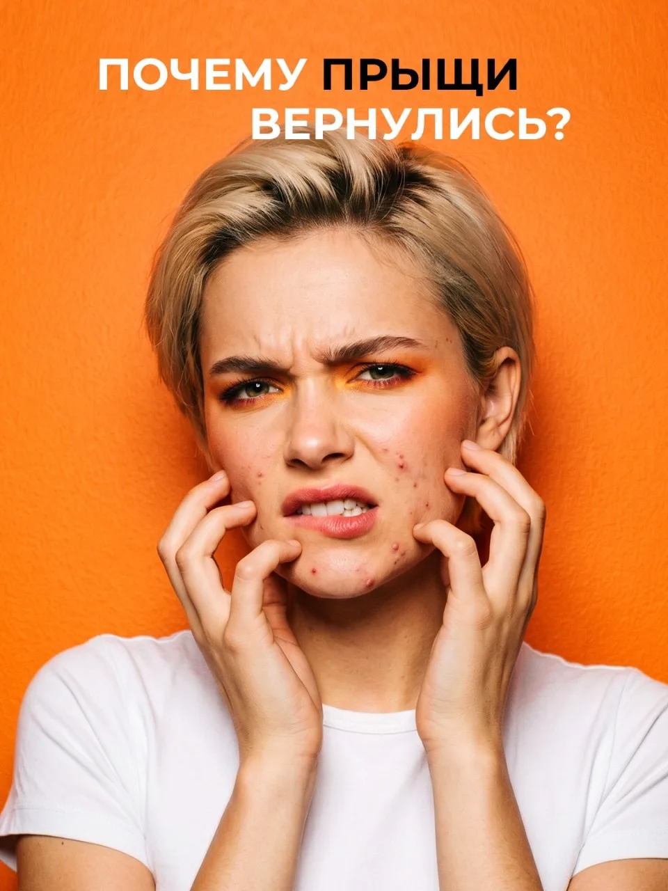 «Пропей антибиотики и все пройдет… Теперь у меня нет иммунитета, а прыщи вернулись с утроенной силой