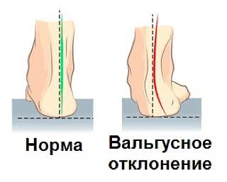Пошагово разберём, что влияет на состояние живота (и осанки в том числе, а это все тоже...