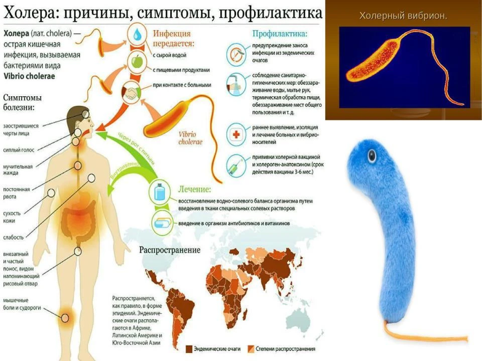 Холера — острая кишечная инфекция, вызываемая бактериямиVibrio cholerae . Относится к о...