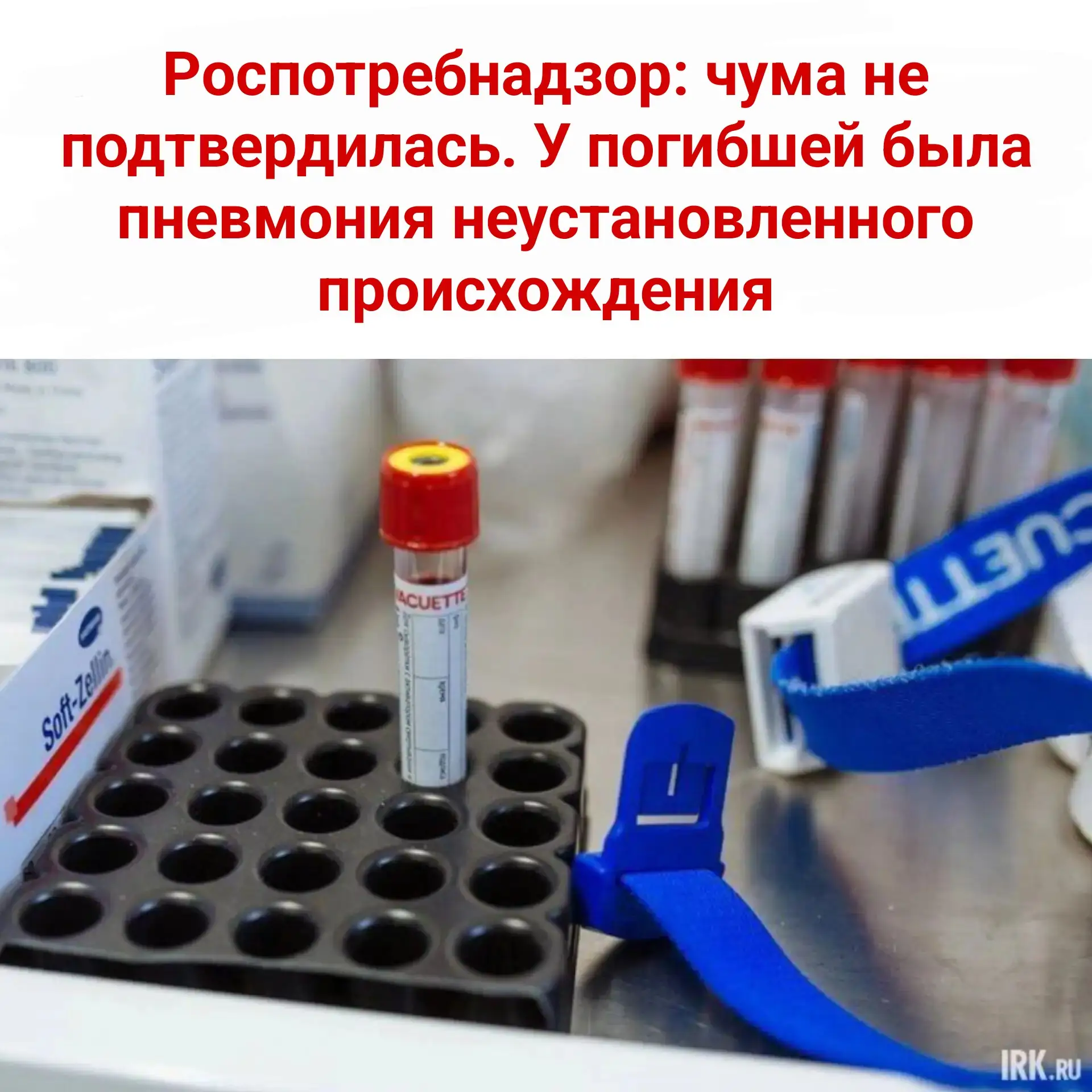 ⚡️ Роспотребнадзор: чума не подтвердилась. У погибшей была пневмония неустановленного п...