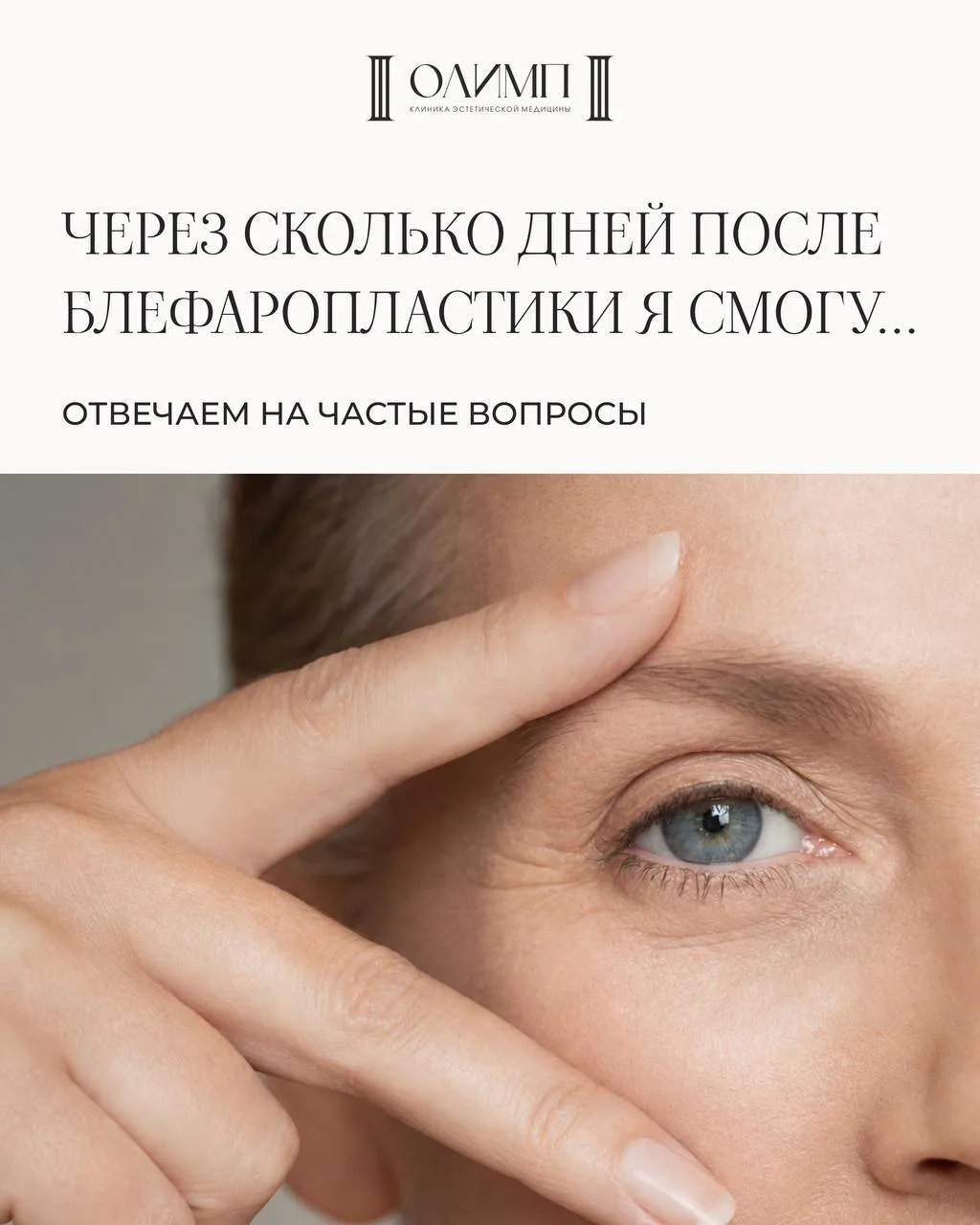 Вторая подборка: через какое время можно после блефаропластики.