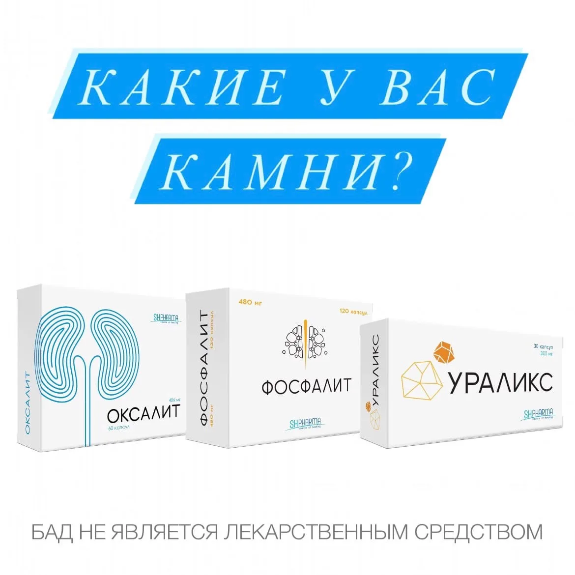 Какие у вас камни?