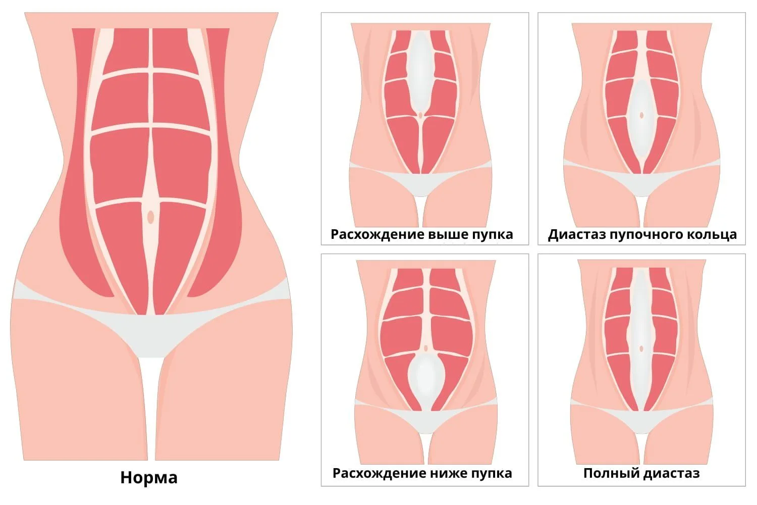 🙄После родов уже все? Тело не восстановить?
