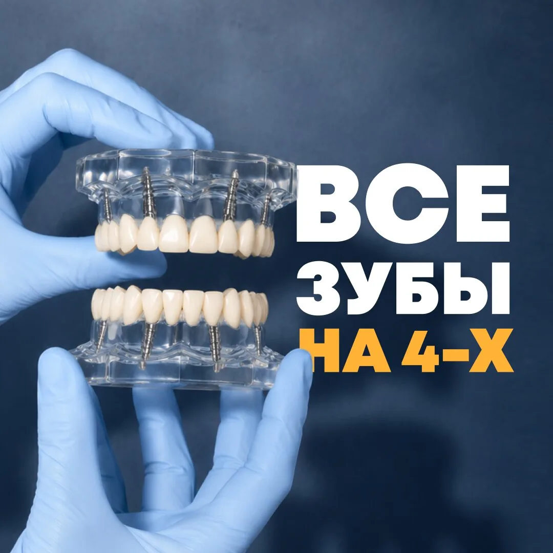 Все зубы за 2 приёма — без съёмных протезов