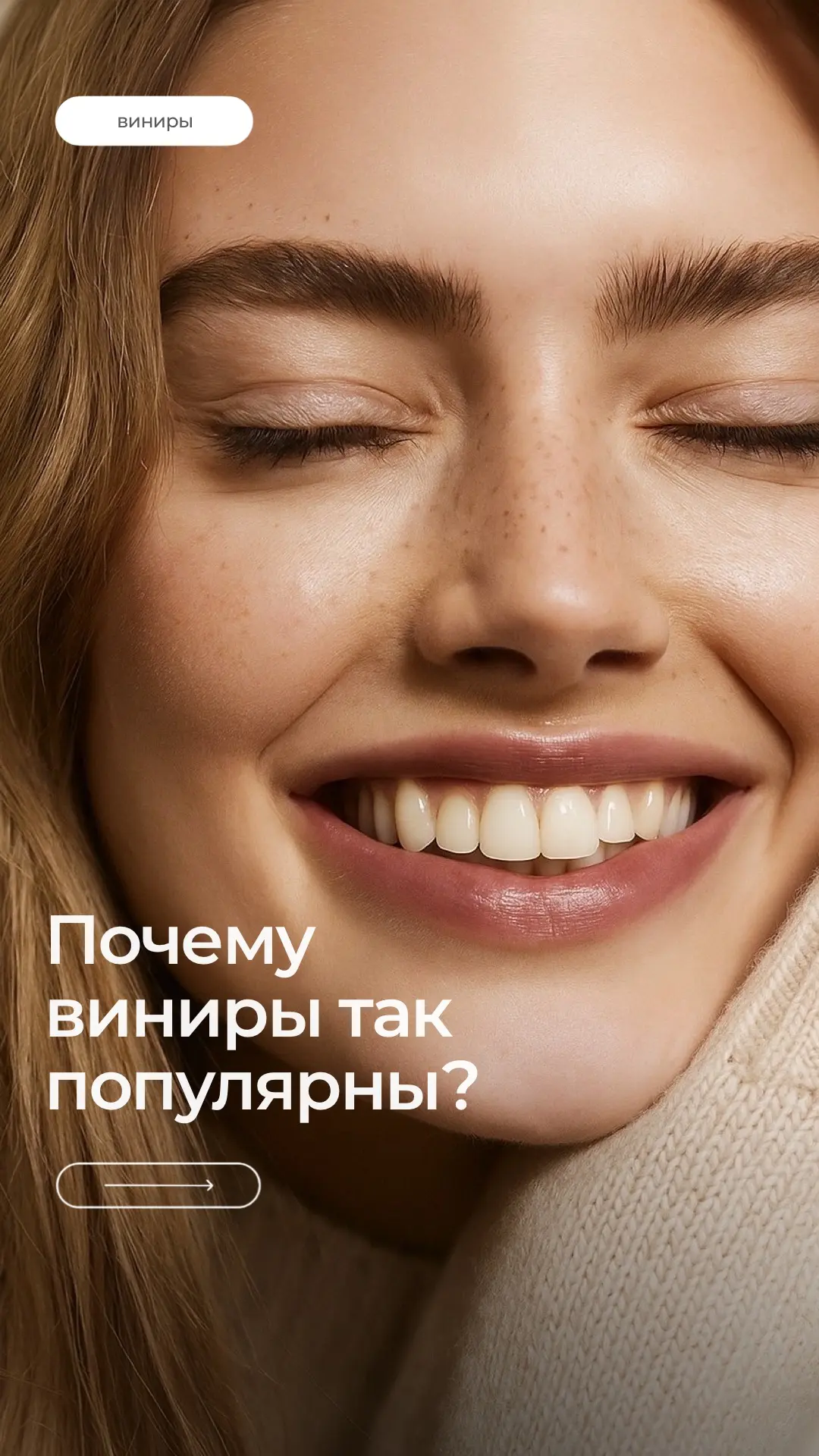 📌 ПОЧЕМУ ВИНИРЫ ТАК ПОПУЛЯРНЫ?