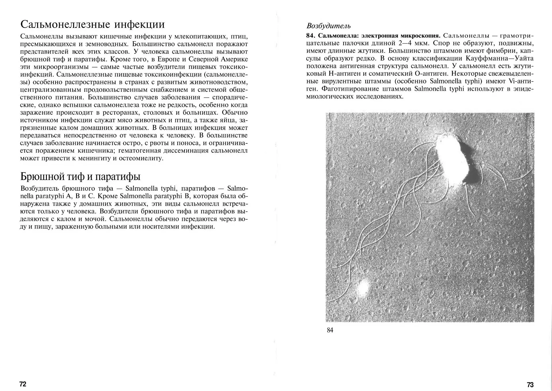 Сальмонеллезные инфекции