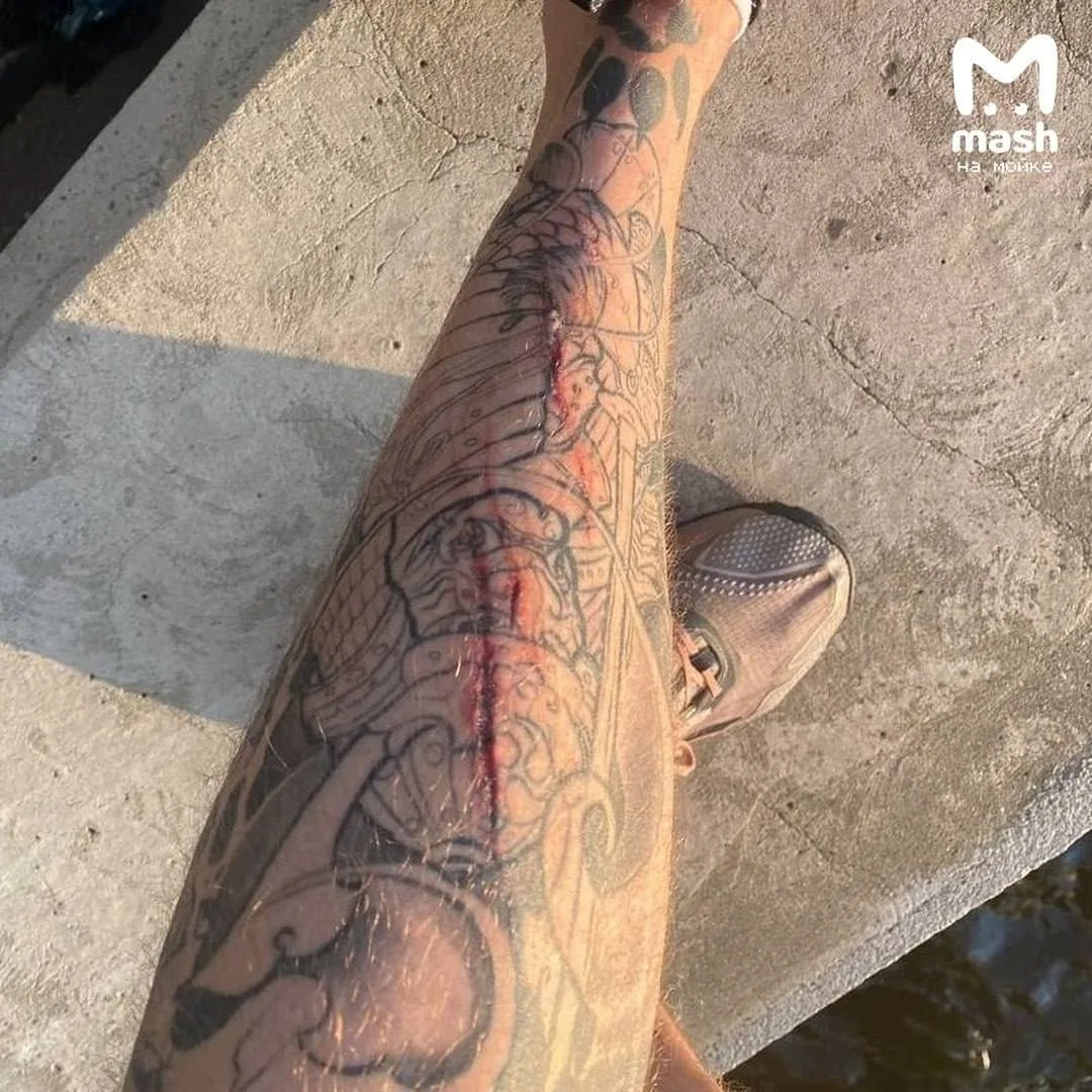 Медведь напал на велосипедиста около КАДа в Янино — последствия встречи на фото.