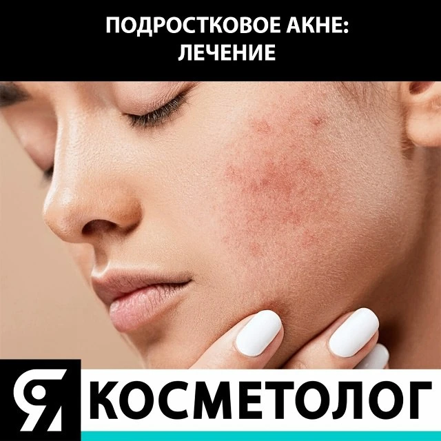 Главным признаком заболевания является сыпь, которая появляется вследствие целого компл...