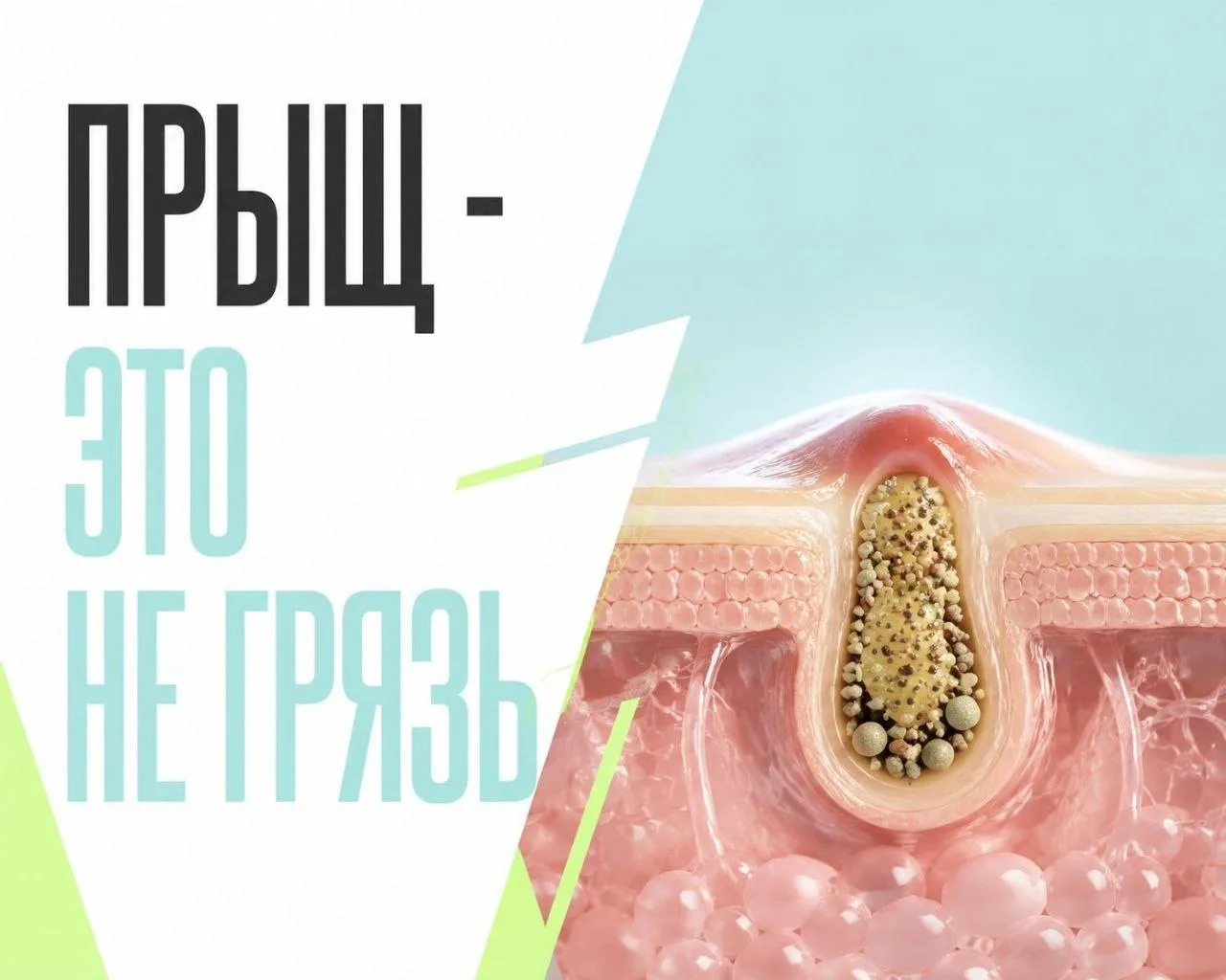 Как на самом деле рождается воспаление?