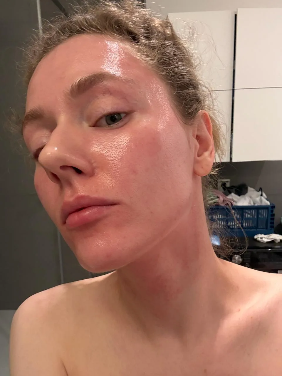 Итак, девочки, отзыв на Dermapen 💅