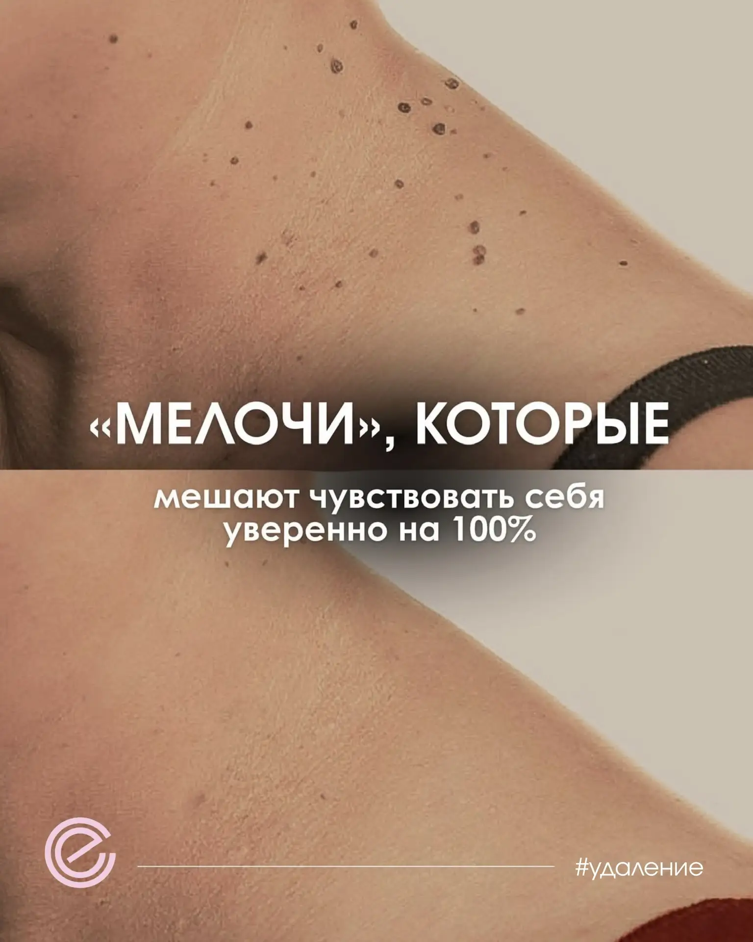 Ювелирная работа в Евромедика: чистота и здоровье вашей кожи 🪄