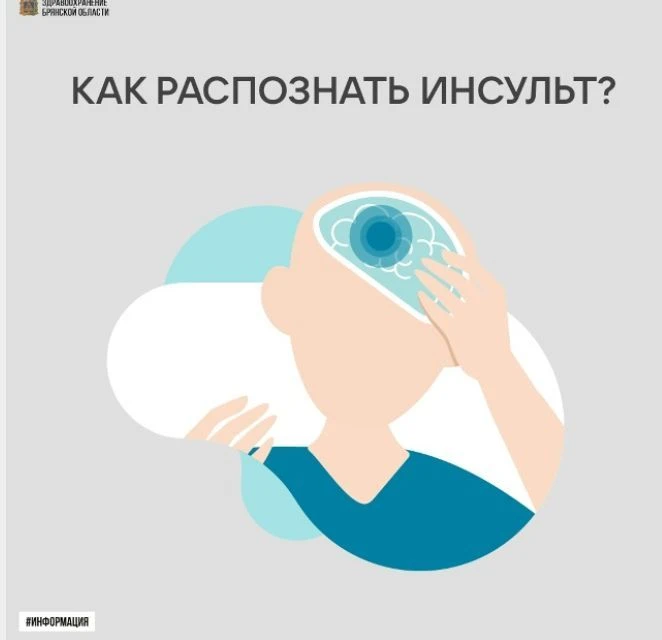 Как распознать инсульт?Если у человека внезапно перекосило лицо, онемела рука или наруш...