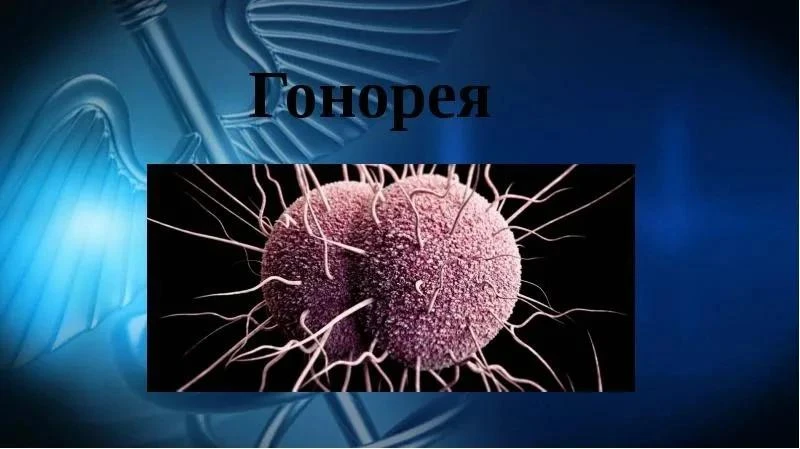 Что такое гонорея

🦠 Гонорея — это бактериальная инфекция, которая чаще всего передаётся при полово