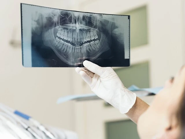 Маникюрша запломбировала зуб гелем для ногтей 🦷

Жительница столицы две недели терпела боль. Сама с