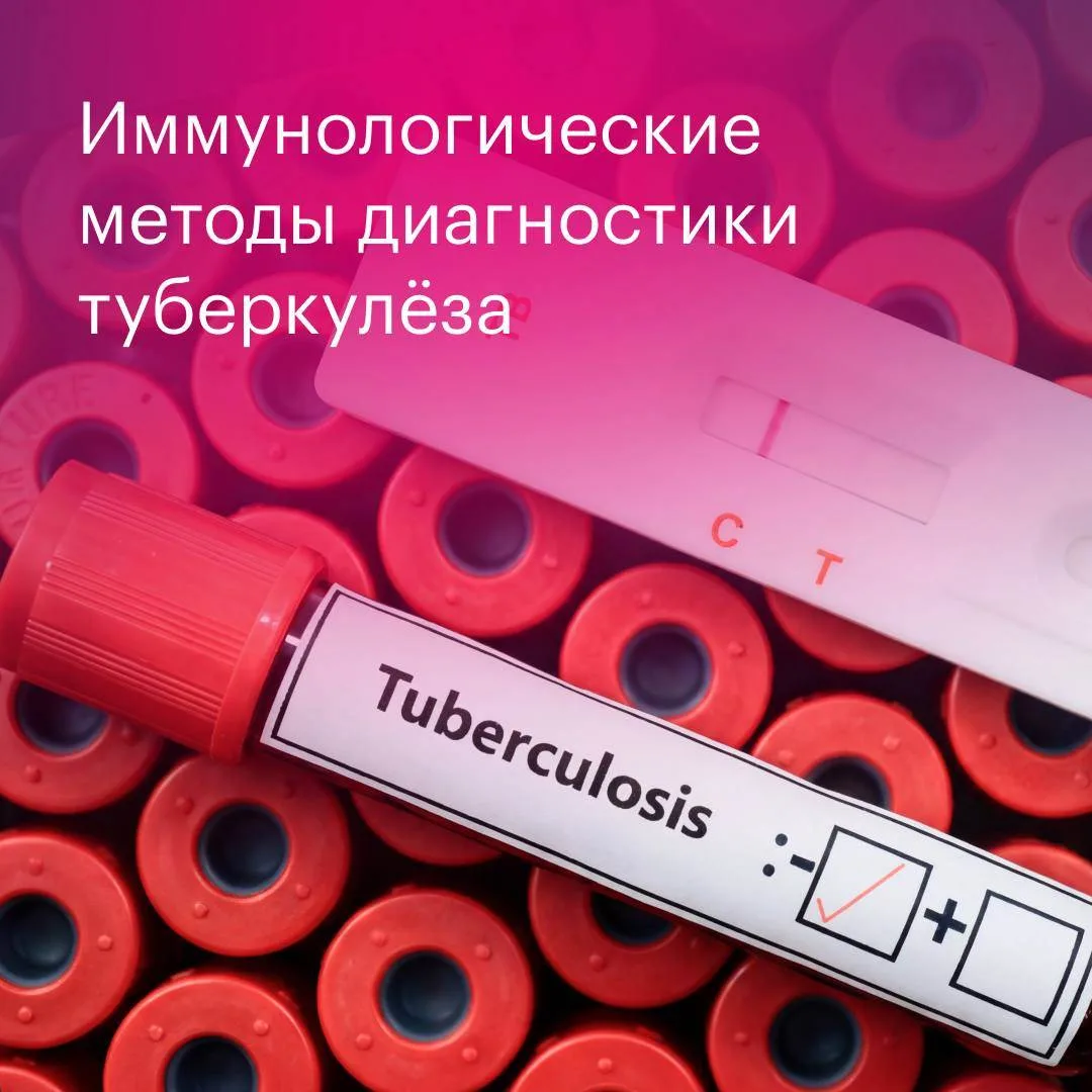 T-SPOT и квантифероновый тест: за пределами пробы Манту