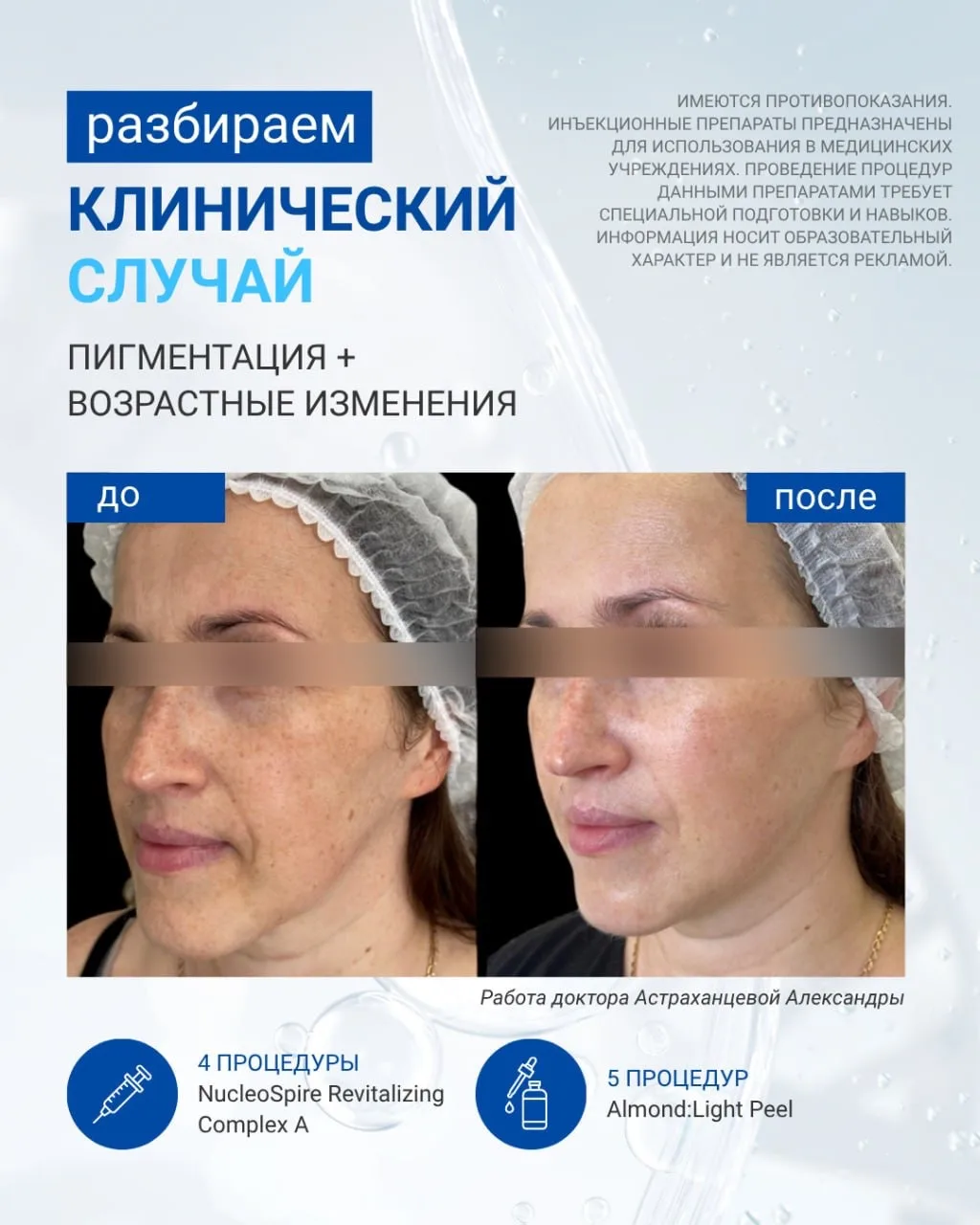 ☀️Неделя, посвященная коррекции гиперпигментации, подходит к концу, и мы хотим завершит...