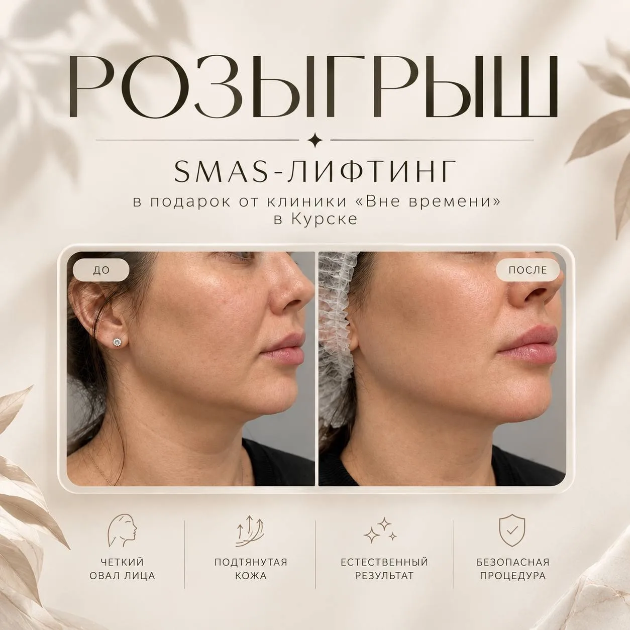 Дарим SMAS-лифтинг на одной из наших подписчиц 🌸