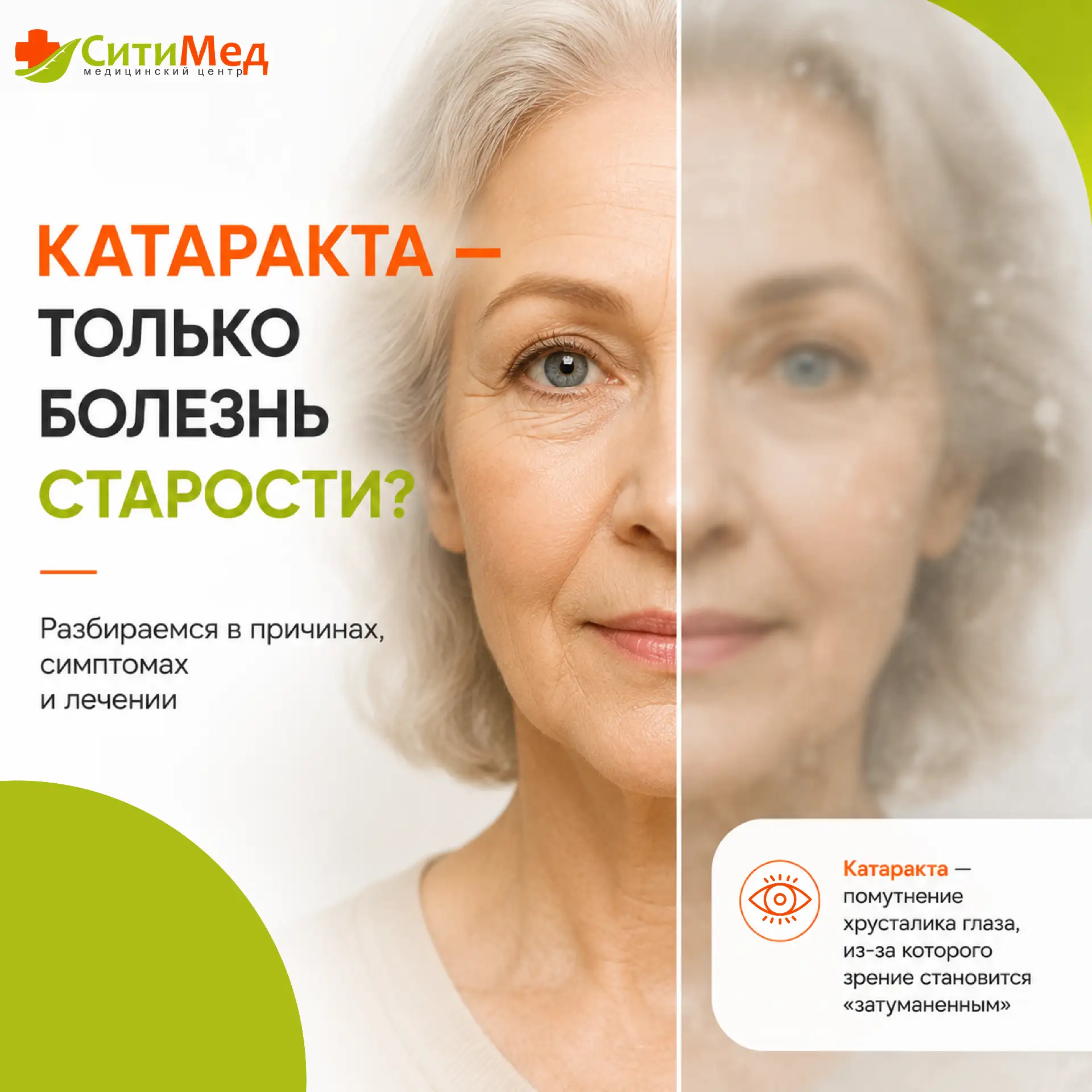 👁️ «КАТАРАКТА» — звучит страшно? Давайте разберемся без паники!