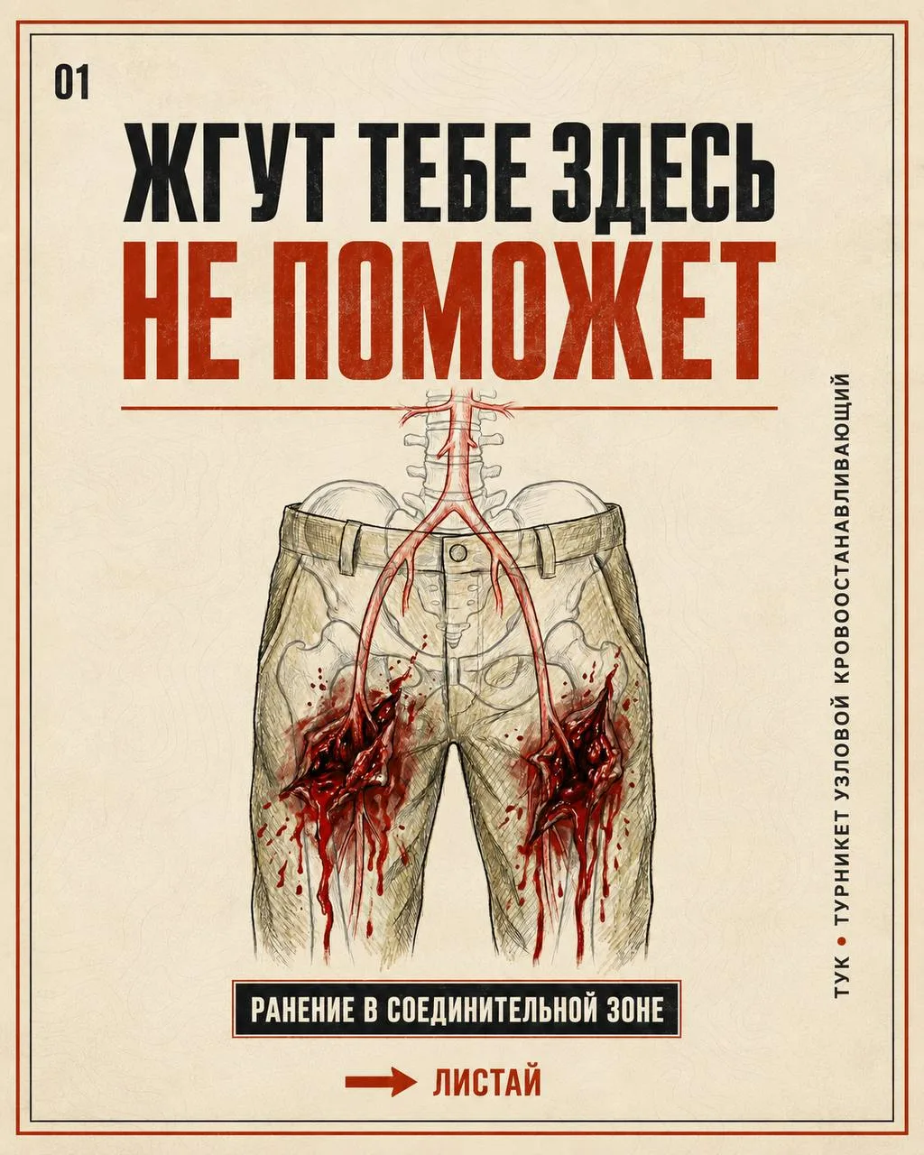ТУК турникет узловой кровоостанавливающий.