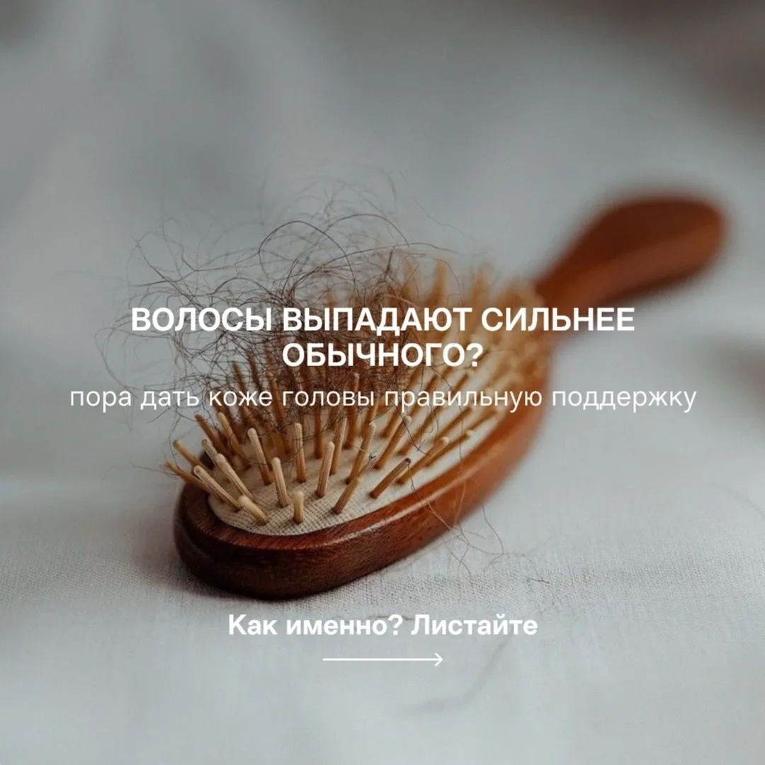 Больше волос на расческе? Это не всегда временно.