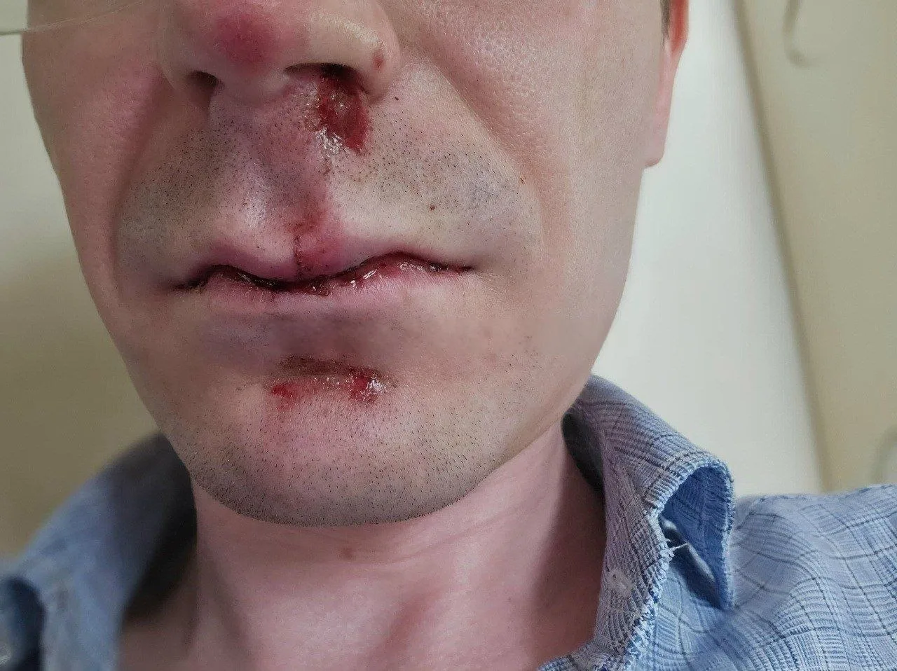 😡Банда подростков избила двух мужчин в Перми 

Школьники напали на молодых людей вблизи перекрестка
