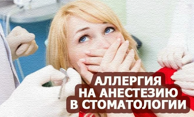 ❓ Миф: аллергические реакции на местные анестетики, применяемые в стоматологии, возника...