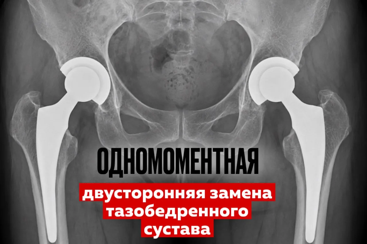 «А можно заменить сразу два сустава за один раз?»