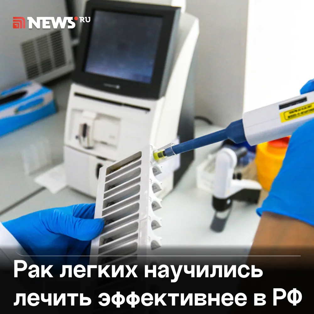 Препарат от диабета неожиданно помог в борьбе с одним из самых опасных видов рака легких.

Российски