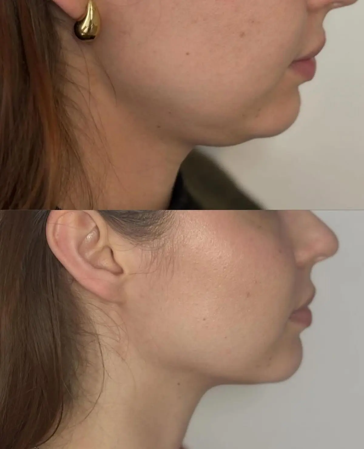🌟 НУЖНЫ МОДЕЛИ КОСМЕТОЛОГУ 🌟

- НА БОТОКС ЛИЦА/FULL FACE 
- ЛИПОЛИТИКИ 
- УВЕЛИЧЕНИЕ ГУБ 
- БИОРЕВ
