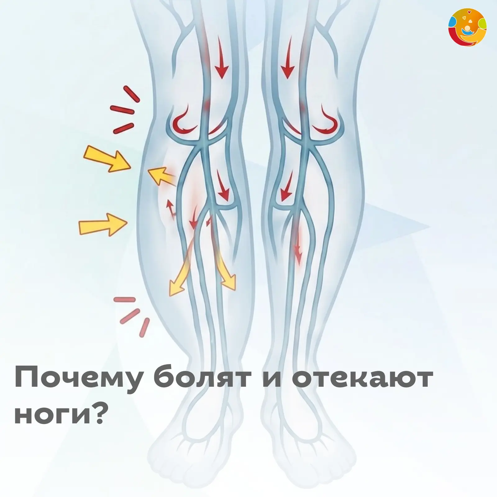 Почему болят и отекают ноги?