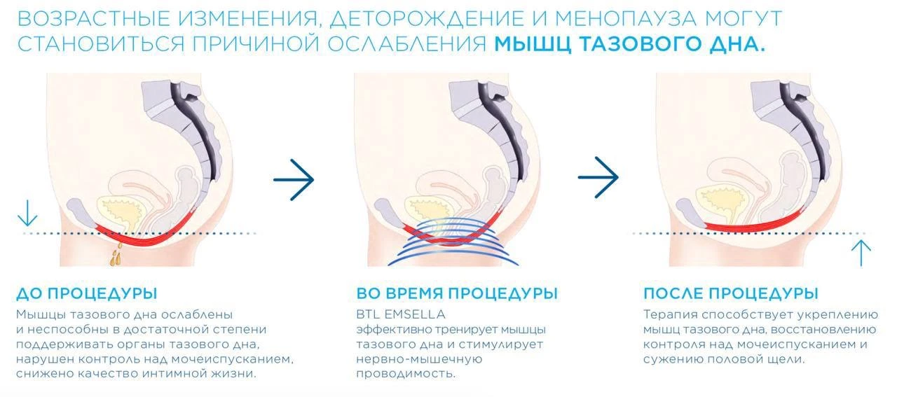 💕 НОВИНКА В «КУЛЬТ»: КРЕСЛО ДЛЯ ИНТИМНОГО ЗДОРОВЬЯ!