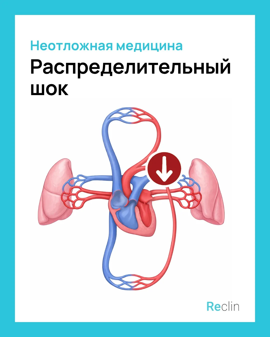 💥 РАСПРЕДЕЛИТЕЛЬНЫЙ ШОК 💥

Давление падает, а кожа тёплая? 😰
Распределительный шок часто путает к