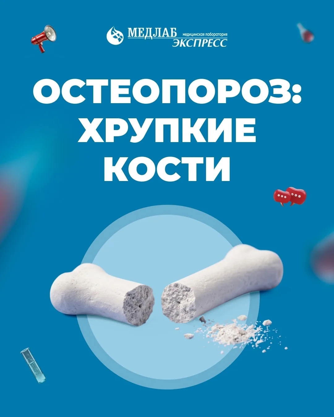 Диагноз «остеопороз» часто ставят случайно.
Человек может чувствовать себя вполне обычно, пока после