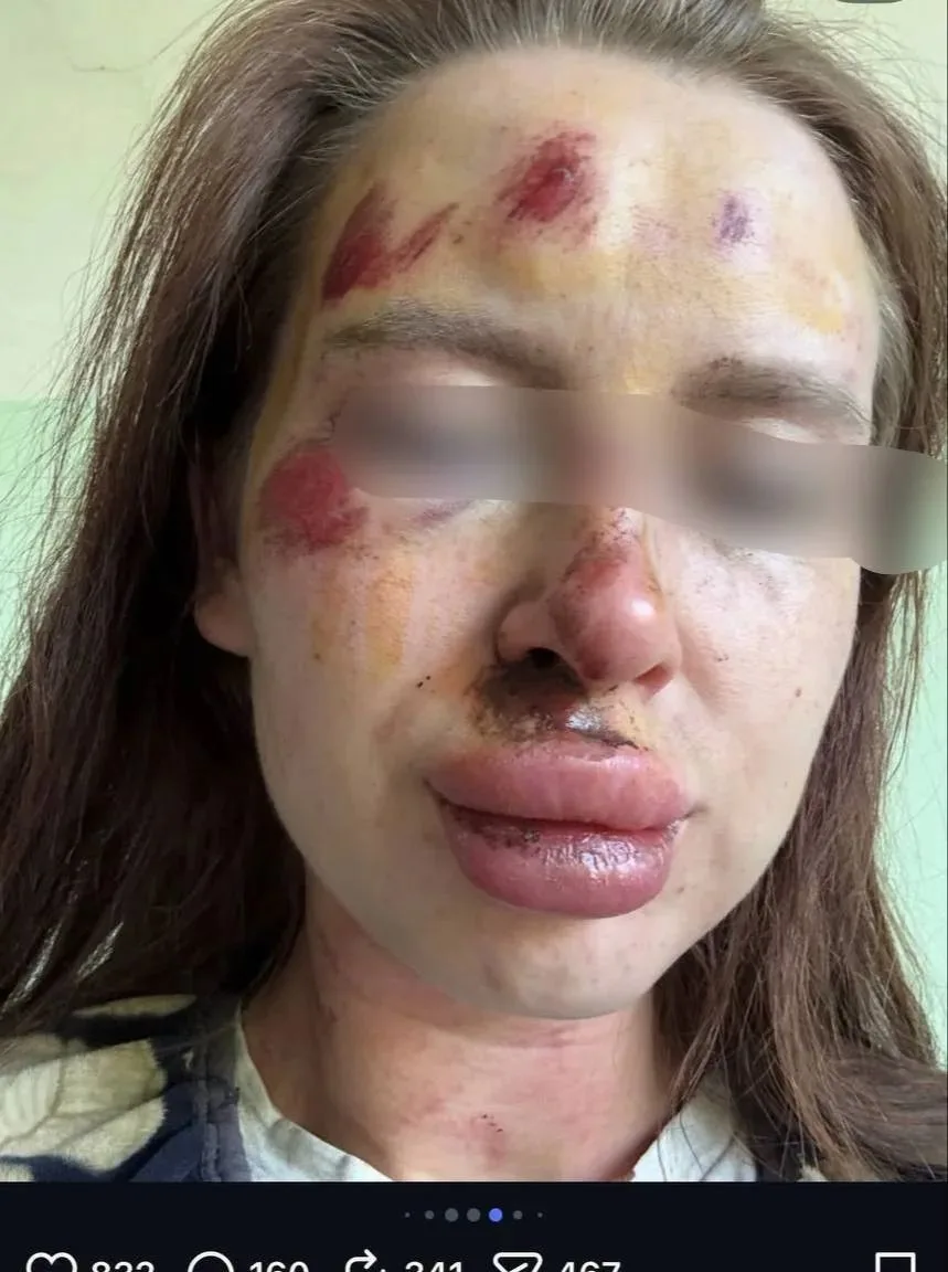 «Он избивает меня при детях»: крик о помощи из Кавалерово.