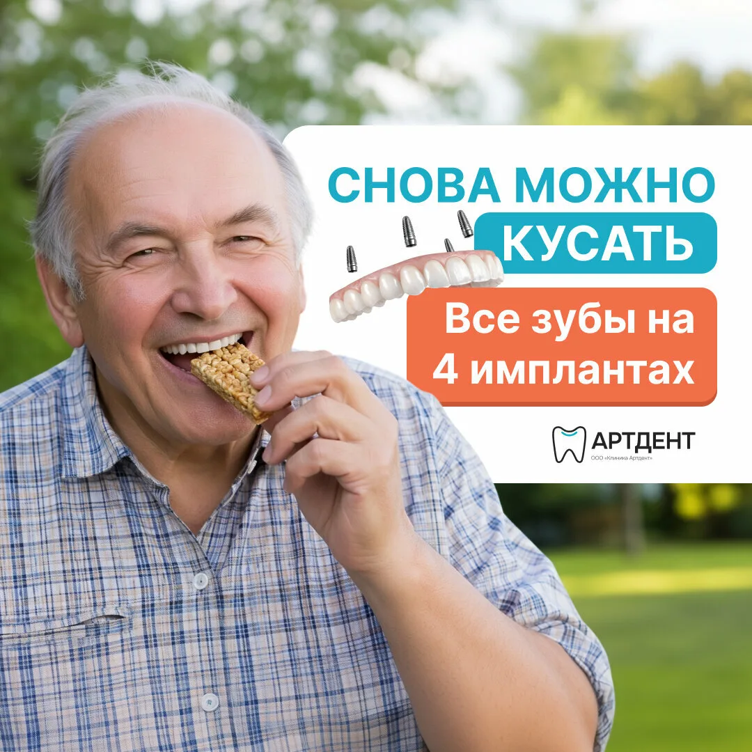 Имплантация зубов на льготных условиях. Скидка от 20000₽