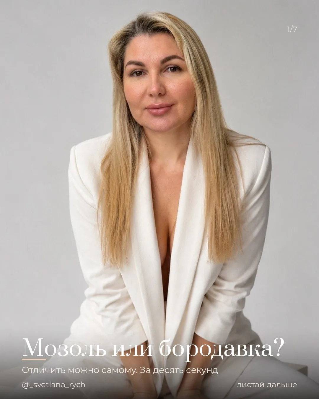 «Мозоль», которую вы пилите уже год, скорее всего не мозоль.