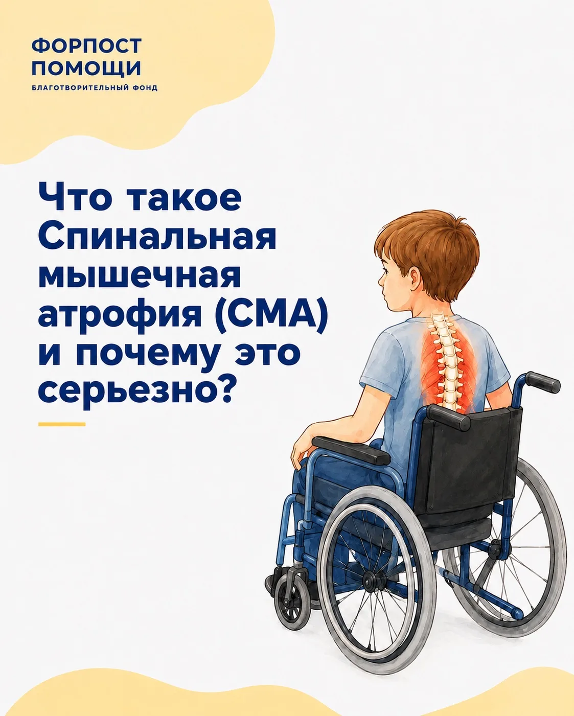Спинальная мышечная атрофия (СМА) — один из самых тяжелых генетических диагнозов. Это з...