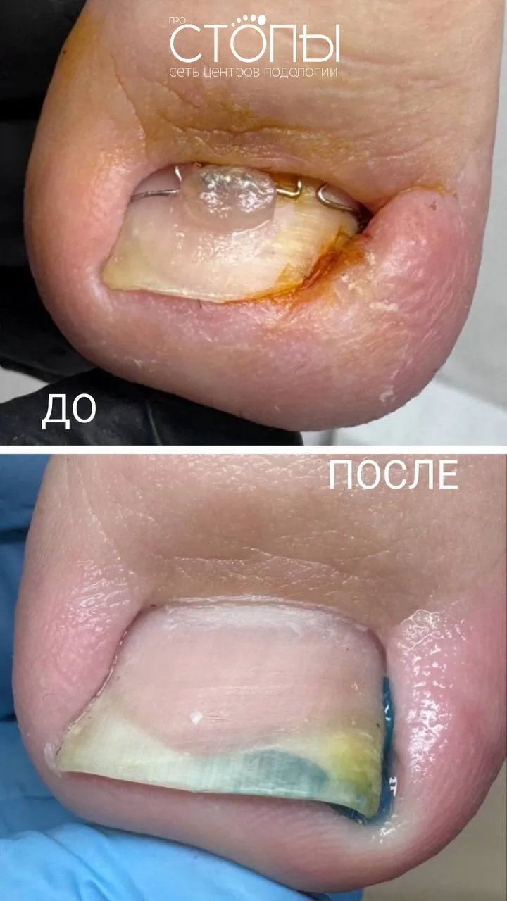 #100ЗАВЕРШЁННЫХ🦶✨