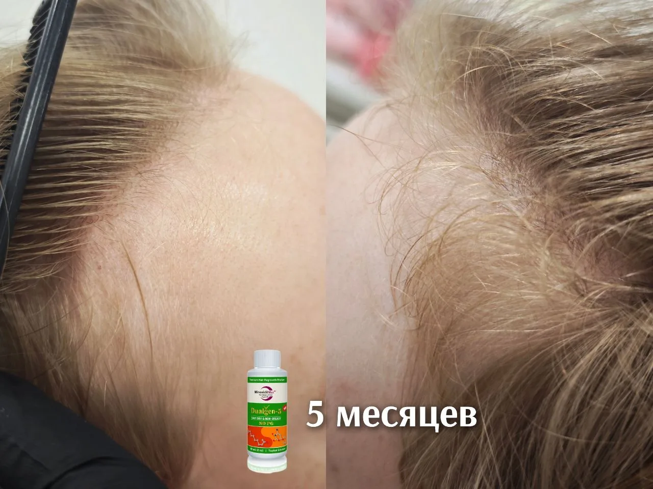 🧴 «До/после» с многими любимым лосьоном Dualgen зелёный.