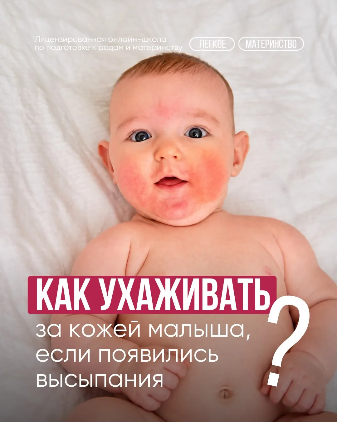 ​​Высыпания у младенца: как правильно ухаживать за кожей?
