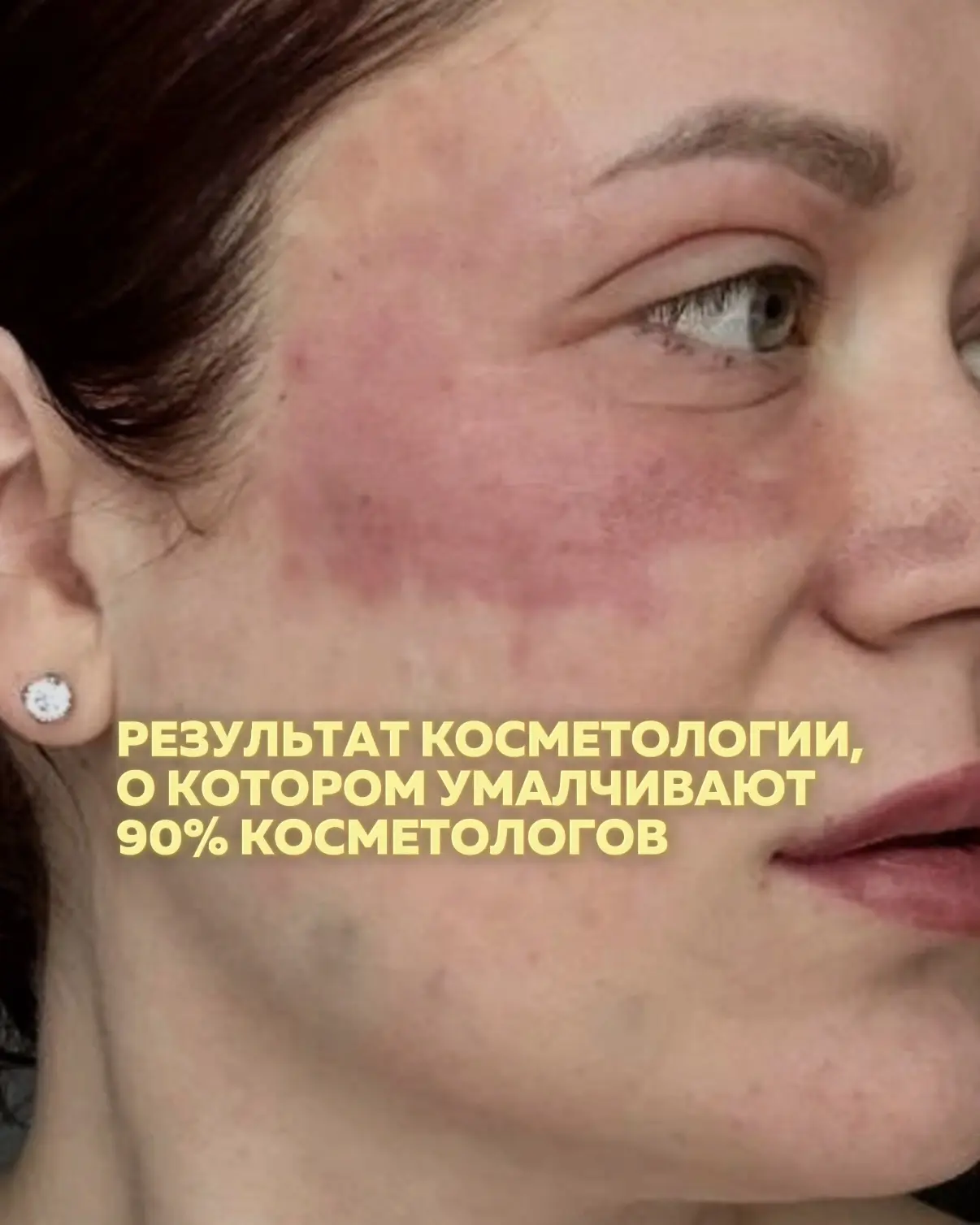 Когда пациент приходит ко мне на консультацию, моя задача — не только подобрать процеду...