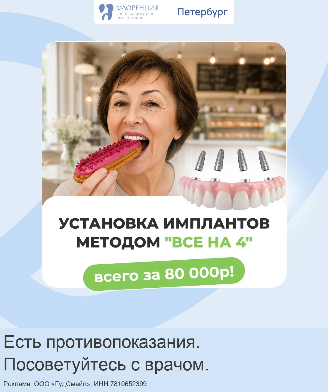 Имплантация по системе "Все зубы сразу на 4х имплантах"!