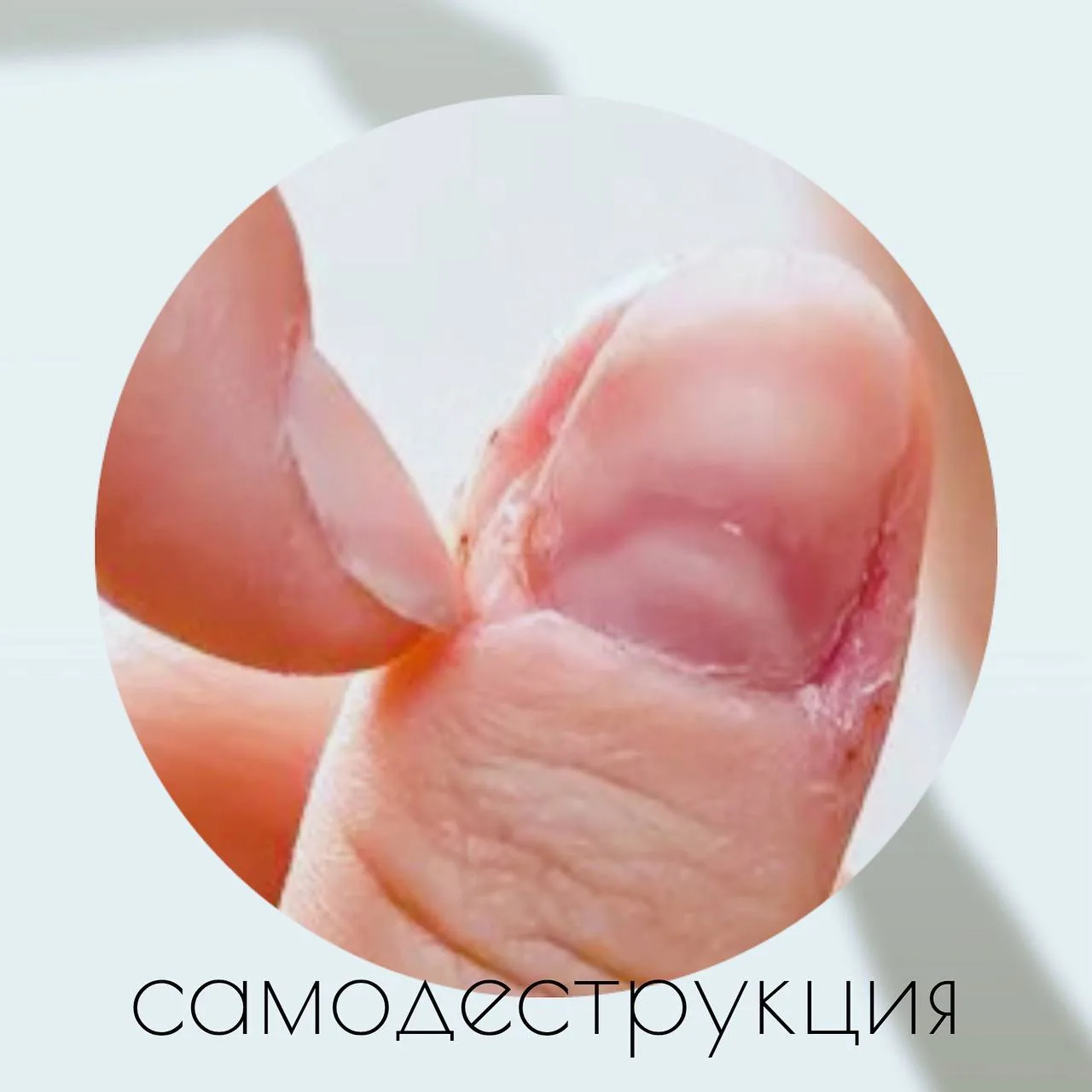Самодеструктивное поведение и повреждение ногтей