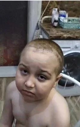 🎗«Рак отступил — но искалечил тело и забрал самое ценное — здоровье ребёнка»💔