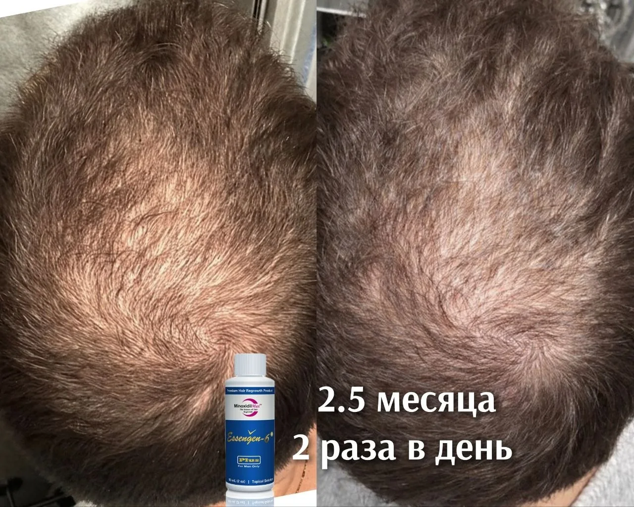 Серия снимков