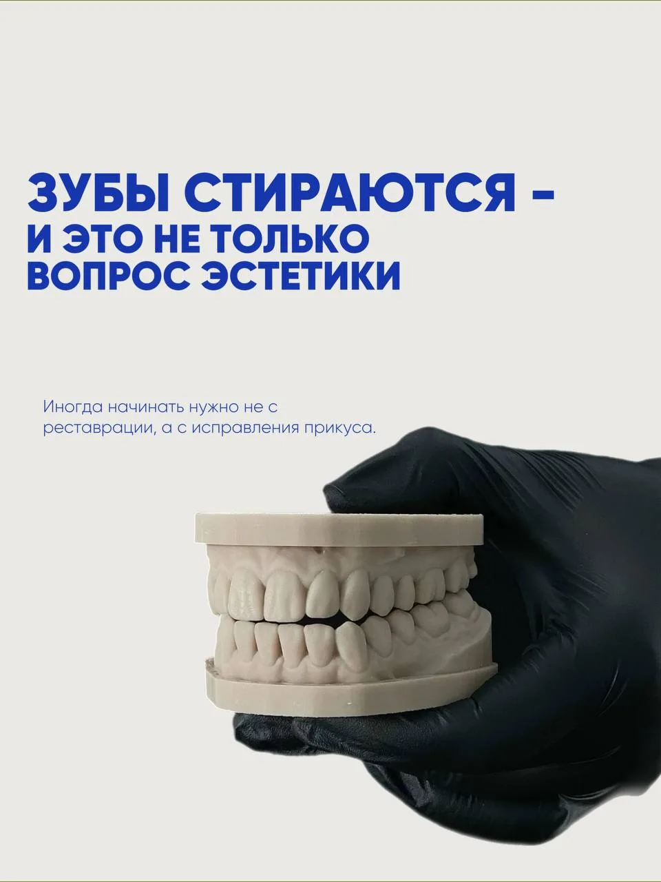 Стираемость зубов - не всегда только эстетическая проблема. Иногда она связана с особен...